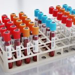 Анализ крови