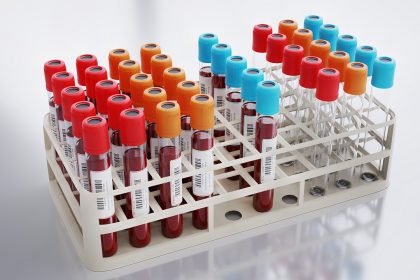 Анализ крови